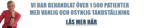 Tandreglering & Tandställningar