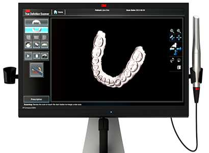3M True Definition Scanner