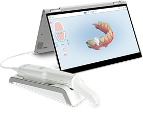 Itero Element Scanner